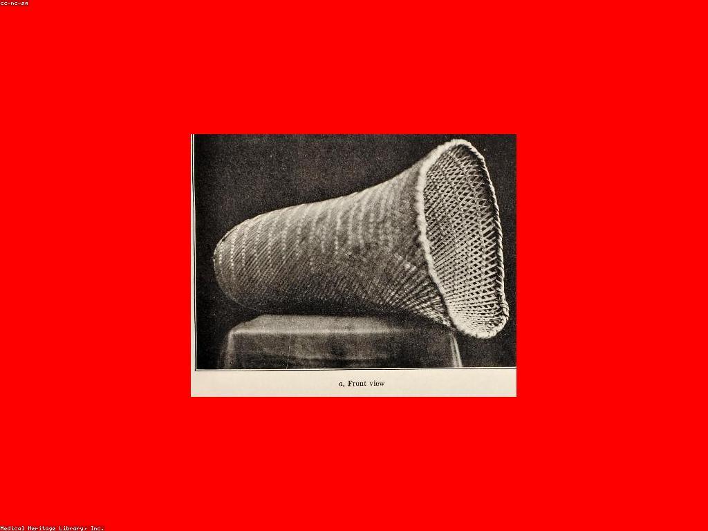 អត្ថប្រយោជន៍នៃការលេងកាស៊ីណូចំពោះសង្គម